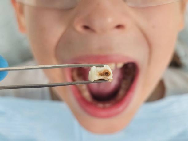 Best Emergency Dental Services for Seniors in Nikiski, AK