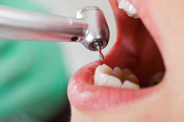 Best Emergency Dentist for Knocked-Out Tooth in Nikiski, AK